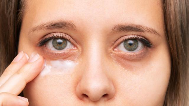 Adiós a las ojeras: el remedio casero que triunfa en España para conseguir un rostro rejuvenecido