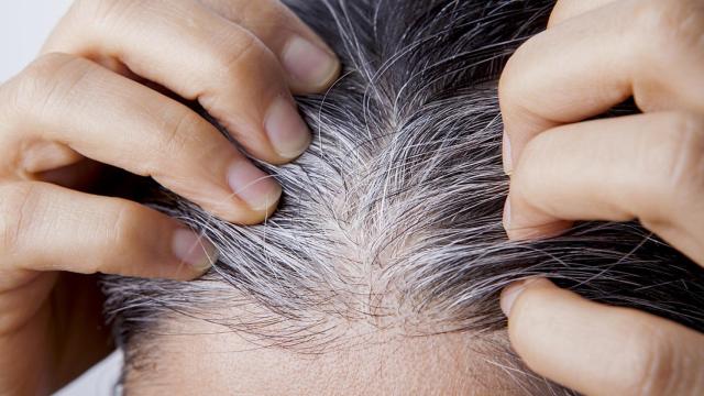 Imagen de una mujer mostrando sus canas.