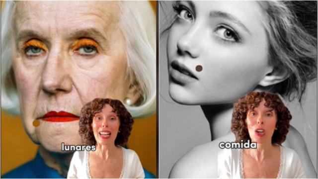 ¿Qué dicen de nosotros los lunares que tenemos en la cara?