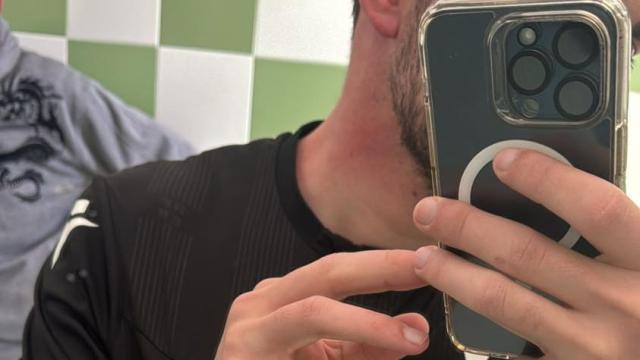 El árbitro agredido en San Pablo de los Montes, con el cuello enrojecido tras recibir el puñetazo.