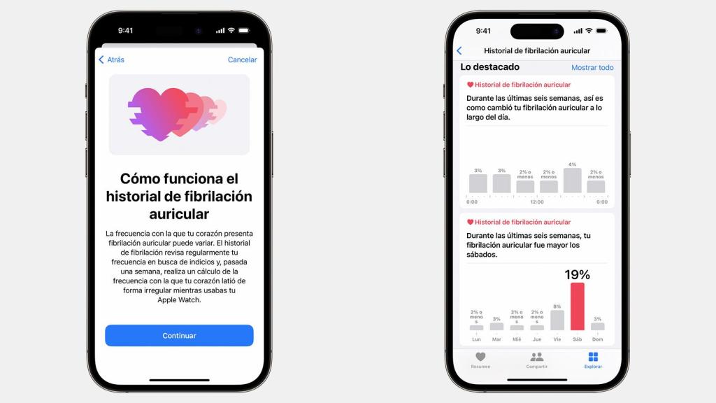 Historial de fibrilación auricular.