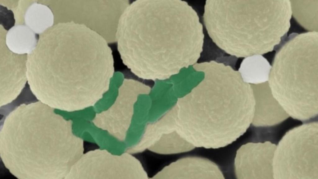 Los microrobots junto a las partículas de plástico y gérmenes vistos en el microscopio