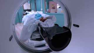 Falsos positivos, biopsias y dinero por el desagüe: el peligro de querer detectar en exceso el cáncer