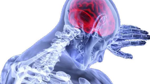 El control neuronal del paciente es clave para el tratamiento del ictus.