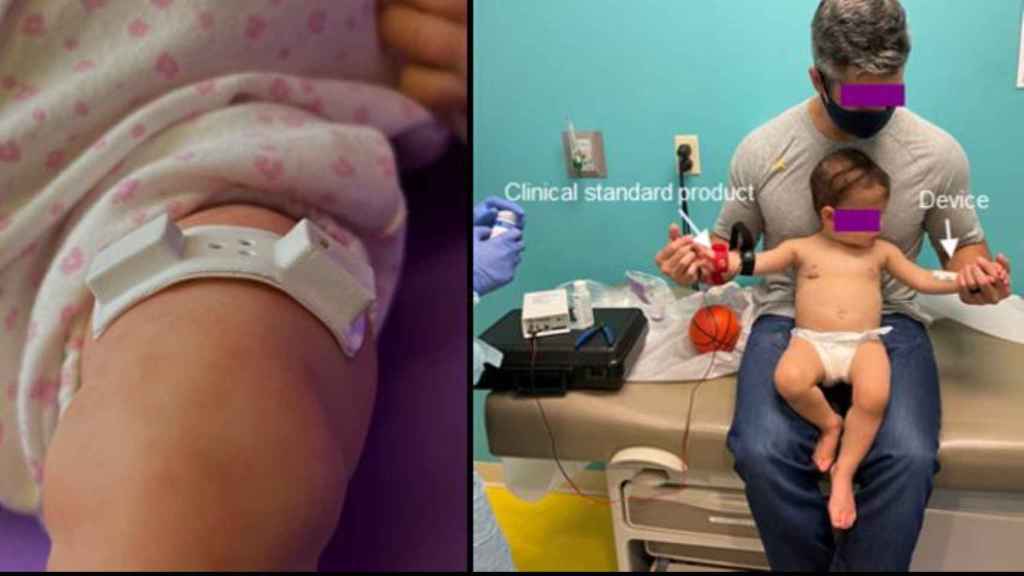 Prueba del dispositivo en un bebé.