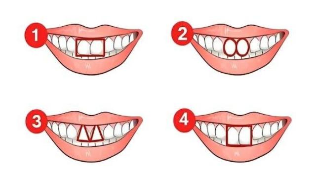 Descubre cuál es tu principal característica de acuerdo a la forma de tus dientes.