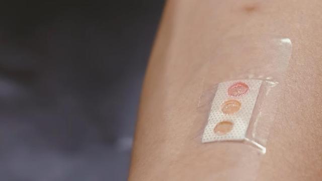 Prototipo de la tirita inteligente para controlar la glucosa