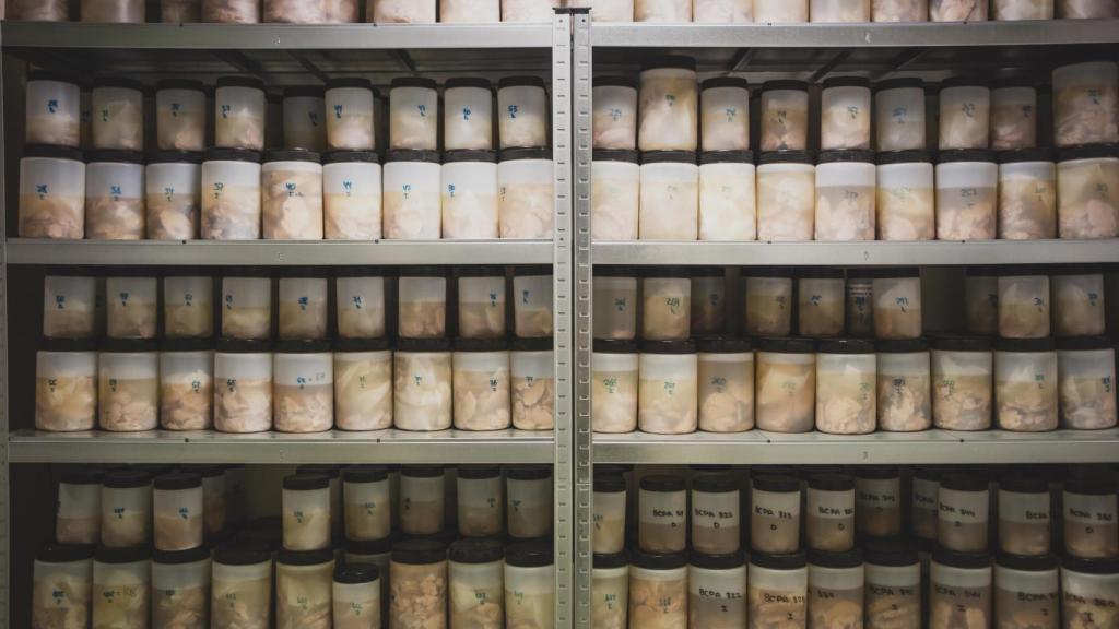 Muestras de los cerebros almacenados en botes con formol en la Fundación CIEN.