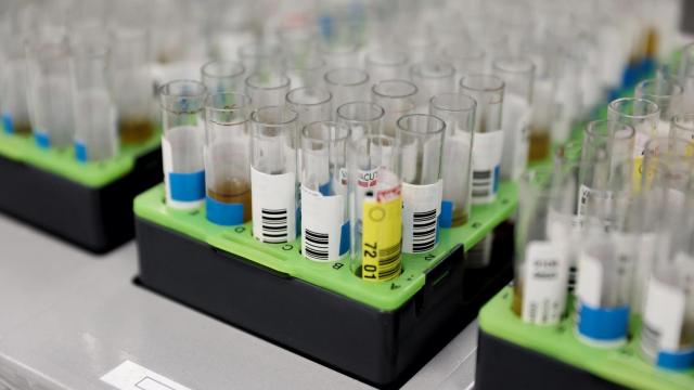Probetas de pruebas PCR en un laboratorio, en una imagen de archivo.