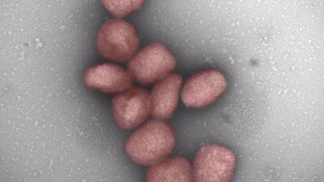 Un Estudio Del Csic Muestra La Presencia Del Virus De La Viruela Del Mono En El Aire Y En La Saliva De Pacientes Infectados