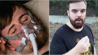 Ibai Llanos y una máscara CPAP.