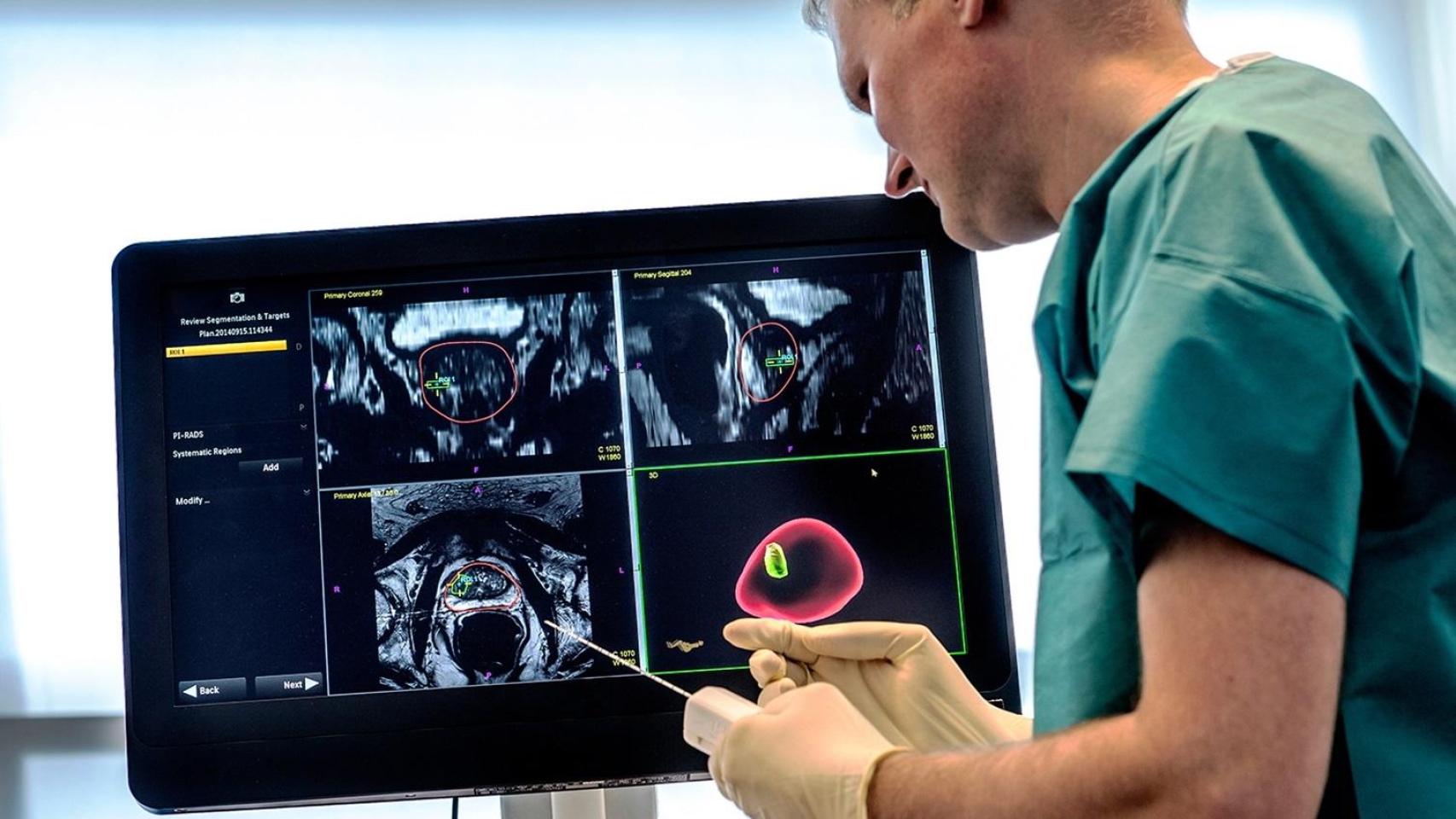 Un sanitario observa imágenes de un cáncer de próstata.