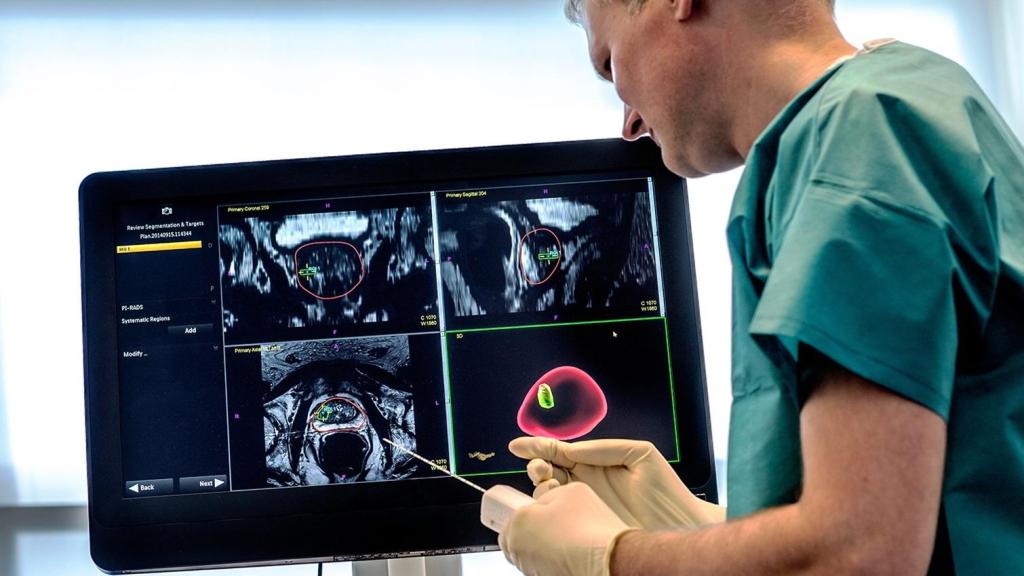 Un sanitario observa imágenes de un cáncer de próstata.