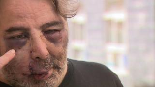 Los medios nacionales se hacen eco de la brutal agresión a un vecino de Ferrol