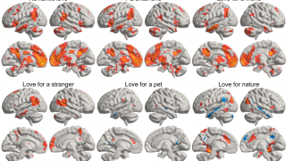 Un-estudio-muestra-como-el-amor-estimula-nuestro-cerebro