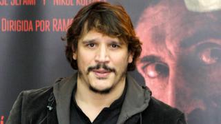 Sergio Peris-Mencheta, tras recibir el trasplante de su hermano: Sus células no reconocen la casa donde están