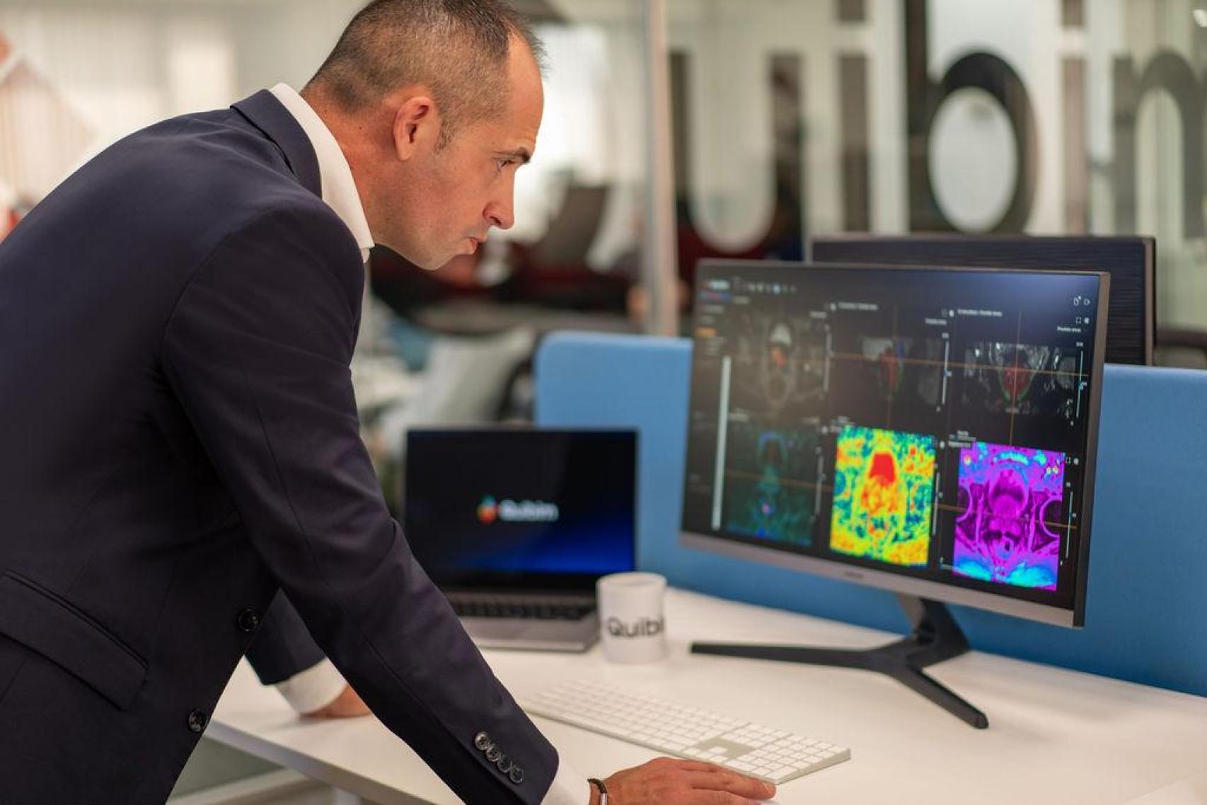 Ángel Alberich ha levantado una empresa internacional pionera en la detección del cáncer por imagen.
