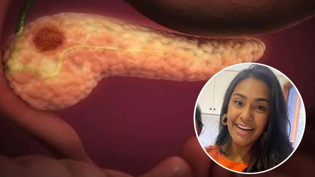 Abby Gnanachelvan fue diagnosticada de cáncer de páncreas en estadio cuatro con sólo 29 años.