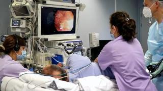 Los médicos desconfían de ampliar el cribado de cáncer de colon pese a su aumento en jóvenes: No es rentable