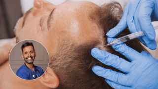 nutriente-evita-calvicie