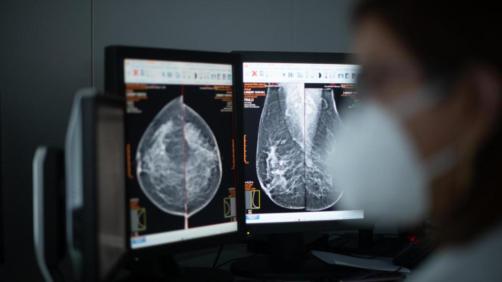 Una doctora observa los resultados de una mamografía.