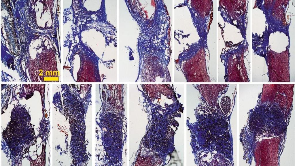 Imagen científica facilitada por el Sescam.