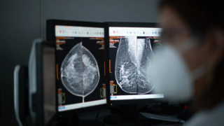 Una doctora observa los resultados de una mamografía.