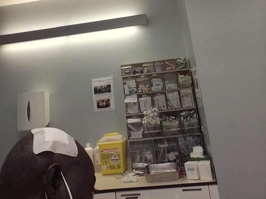 Samake tras recibir varios puntos en la cabeza por el atropello.