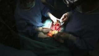 Imagen de archivo de un trasplante de corazón en el quirófano de un hospital.