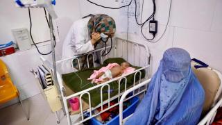 Una doctora de Médicos sin Fronteras reconoce a un bebé con malnutrición en Herat.