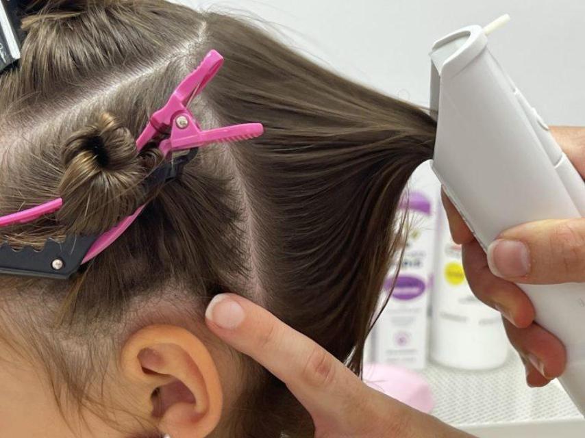 Tratamiento para la eliminación de piojos.