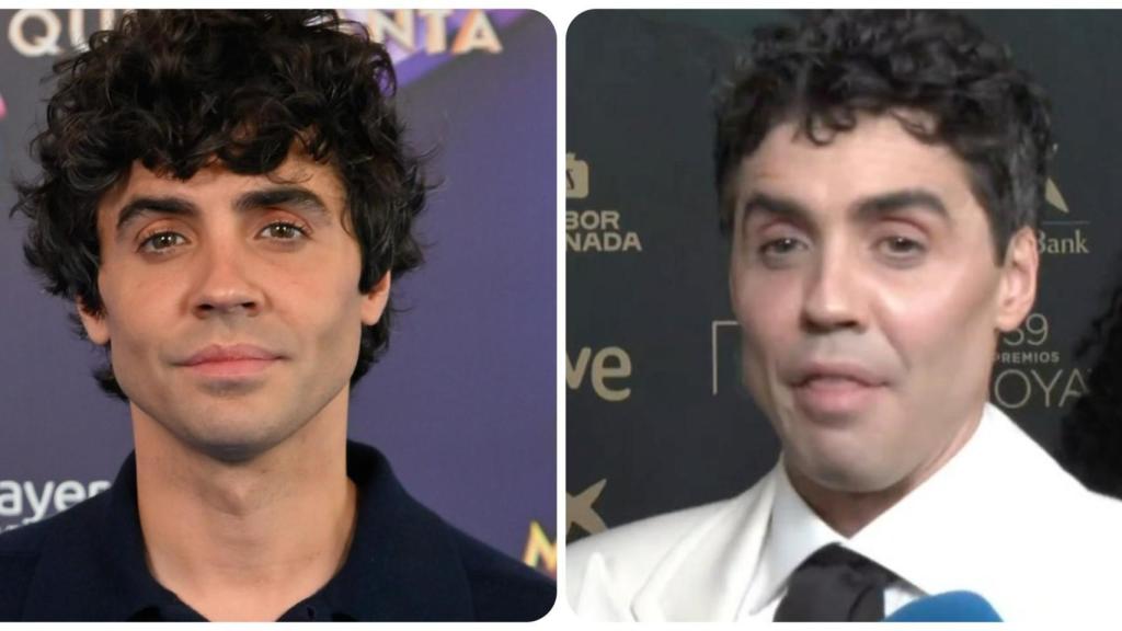 El cambio en el rostro de Javier Ambrossi.