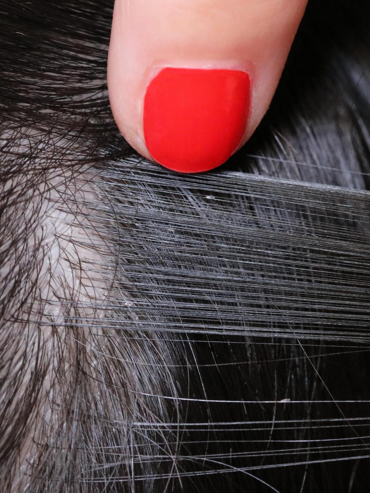 Un piojo, en una foto de archivo.