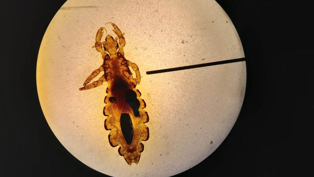 Piojo en un microscopio.