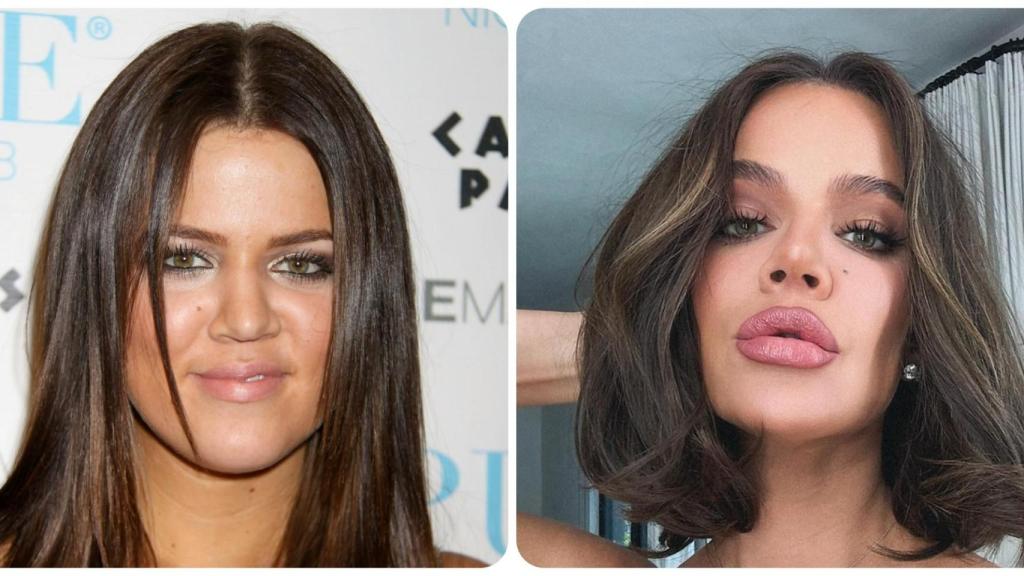 Khloé Kardashian, antes y después.