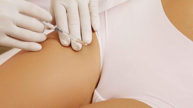 Una mujer sometiéndose a una cirugía íntima.