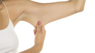 Imagen de archivo de los brazos de una mujer.