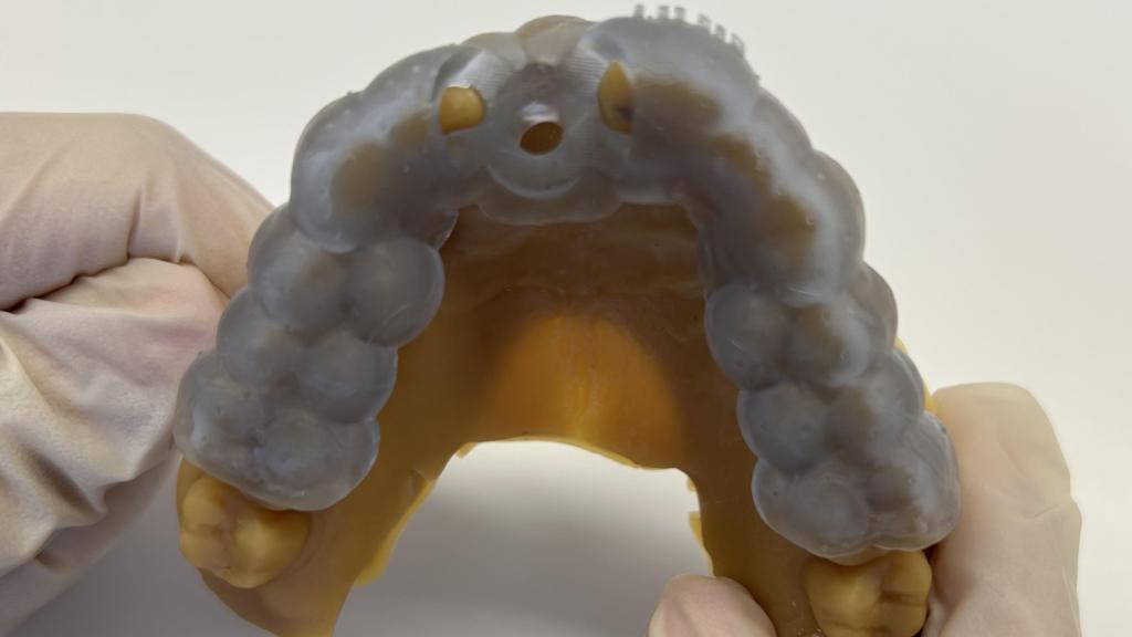 Férula de cirugía guiada