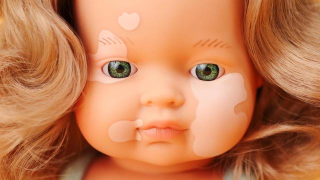 La muñeca con vitíligo que fabrica Miniland en Alicante.