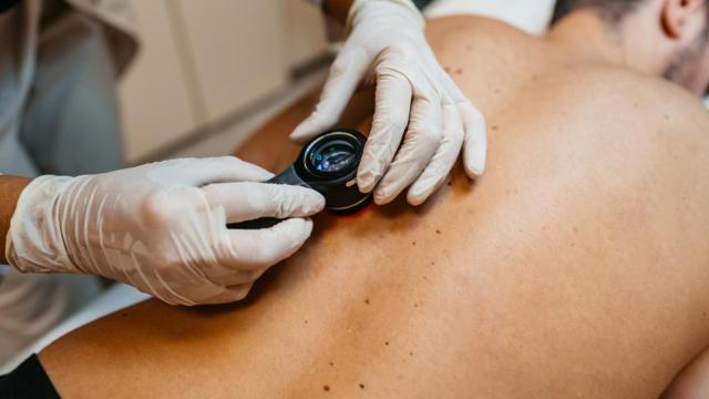 Una doctora examina las marcas de la piel de un paciente.