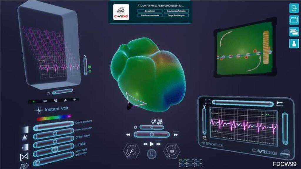 La startup ha desarrollado un método no invasivo para diagnosticar y tratar las enfermedades cardíacas.