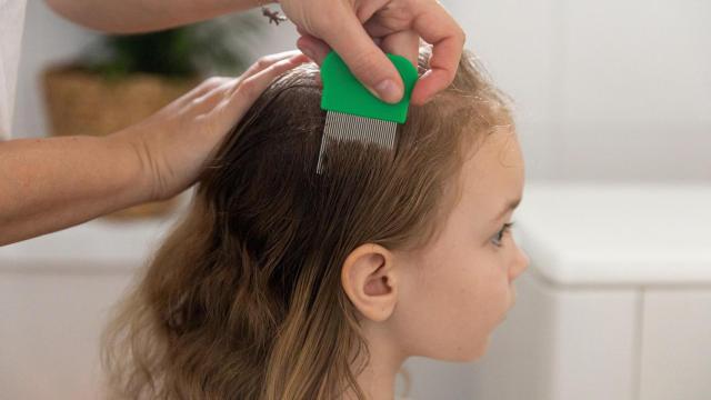 La aparición de piojos no tiene nada que ver con una mala higiene.