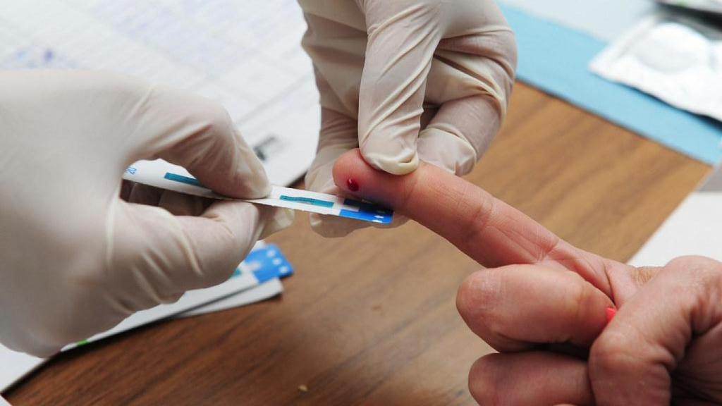 Imagen de recurso de la prueba diagnóstica de una ITS.