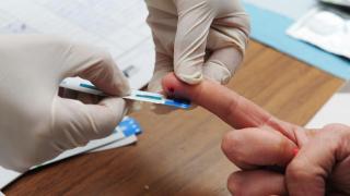 Imagen de recurso de la prueba diagnóstica de una ITS.