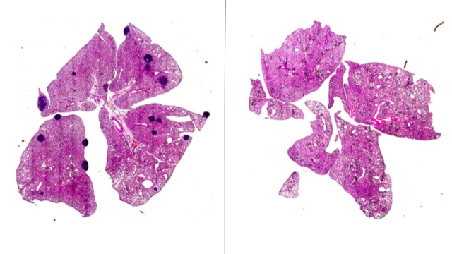 Pulmones de ratón, con tumores a causa de la metástasis (puntos negros) en el que no fue tratado en comparación con el que recibió aspirina.