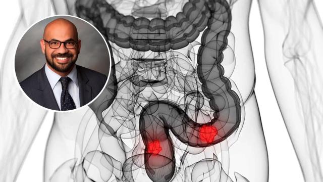 El cirujano Mark Soliman.