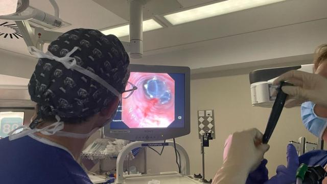 Colocación de válvulas endobronquiales en el Hospital Quirónsalud Sagrado Corazón.