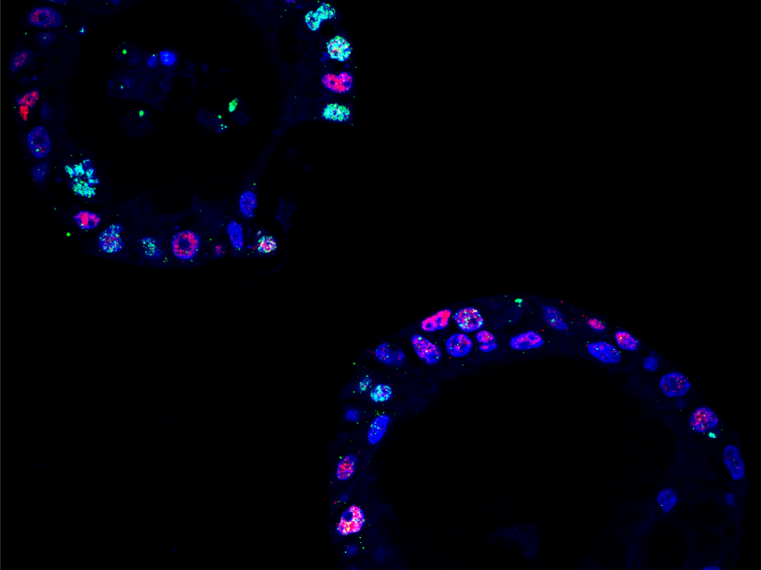 Imágenes de inmunofluorescencia que muestran que las células con niveles más altos de la proteína MYC.