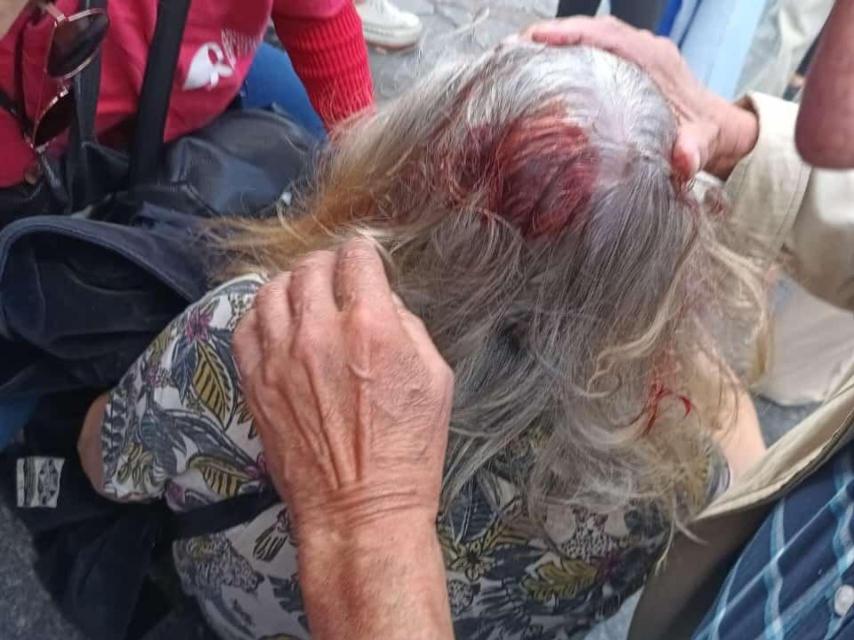 Una jubilada herida en la manifestación.