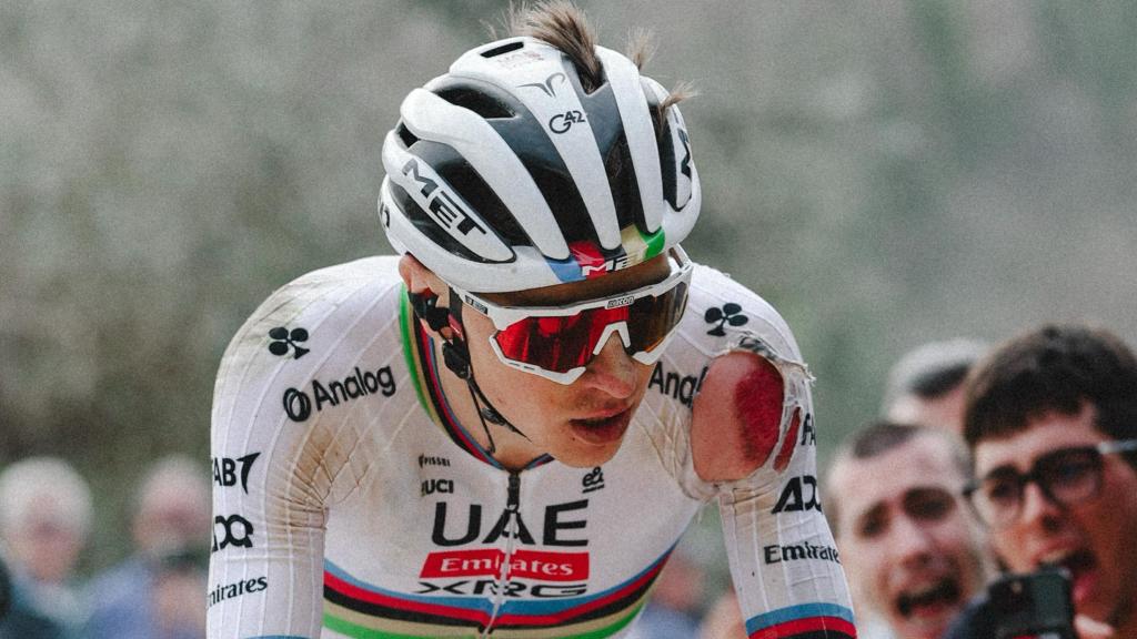 Tadej Pogacar, ensangrentado mientras corre la Strade Bianche.